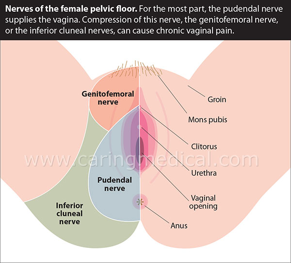 nevralgia del pudendo panagiotakos femmina